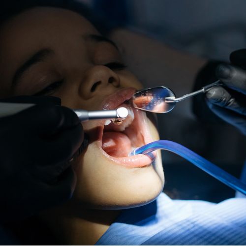 Imagen de servicio de odontología en Barranquilla. IPS Carvalsalud.